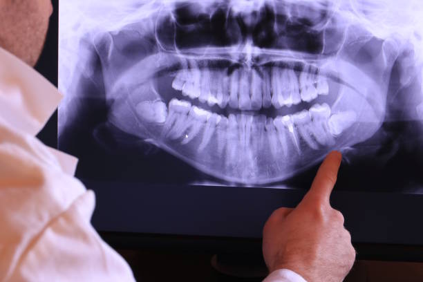 Best Emergency Dental Care for Abscessed Tooth in West Ack, NY
