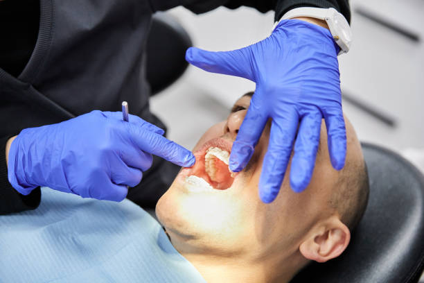 Best Emergency Dentist for Knocked-Out Tooth in West Ack, NY